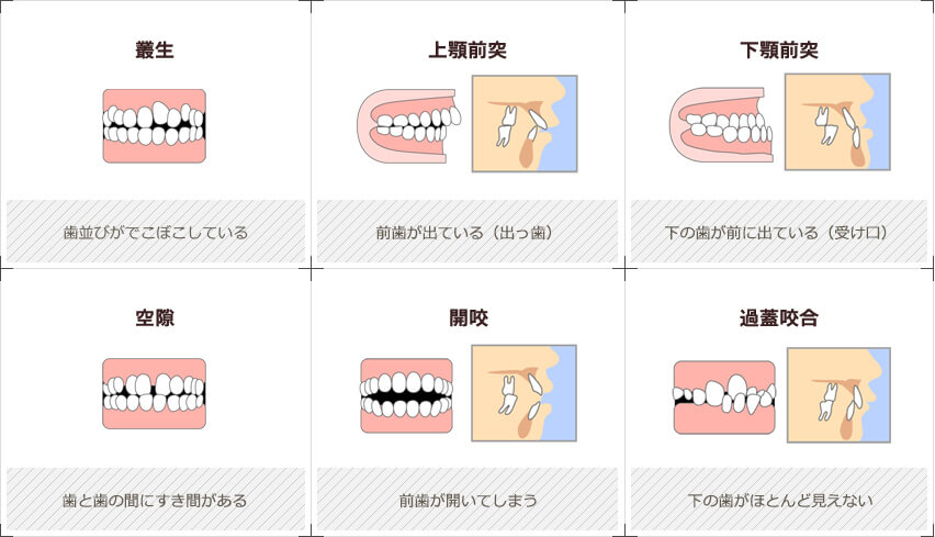 このような症状はございませんか？