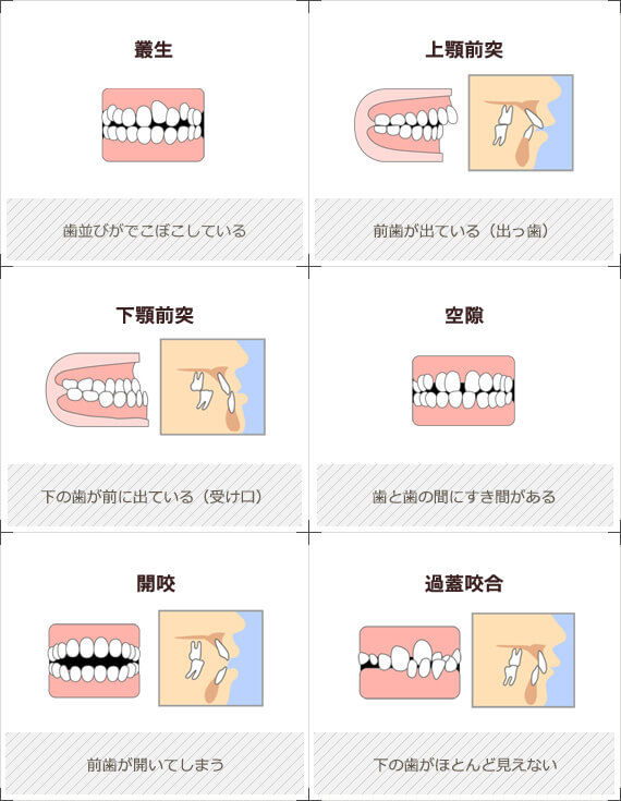 このような症状はございませんか？