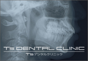 精密検査・診断